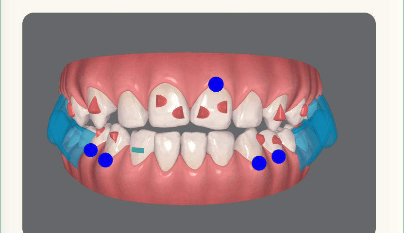 A specialist designs your plan