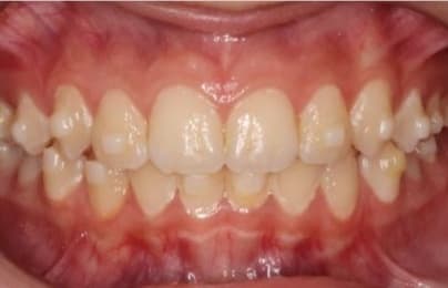 Case 12 after