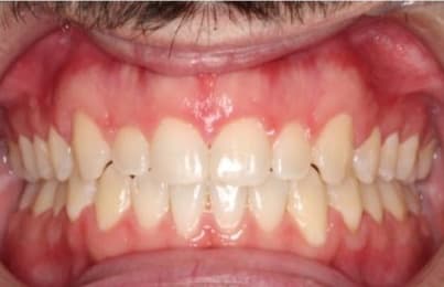 Case 13 after