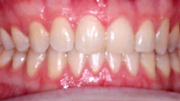 Case 1 after
