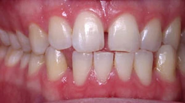 Case 1 before