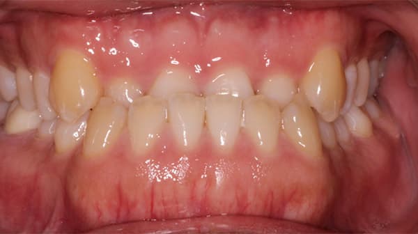 Case 2 before