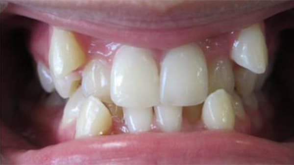 Case 4 before