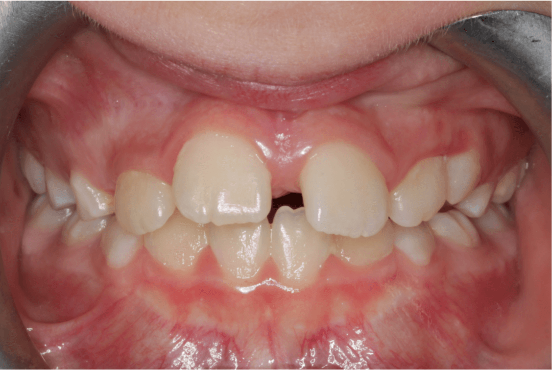 Case 7 before